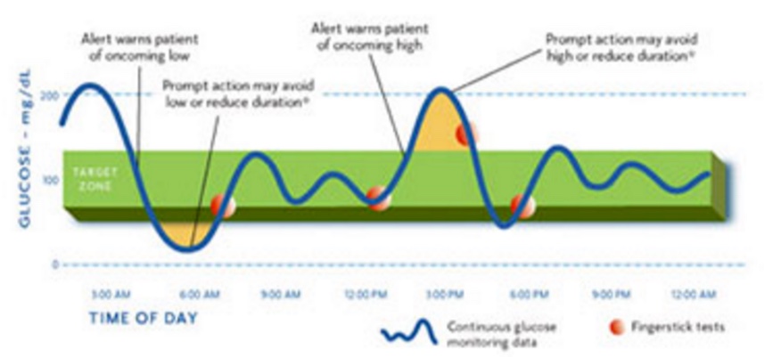 Непрерывная Глюкоза Monitor (CGM) график