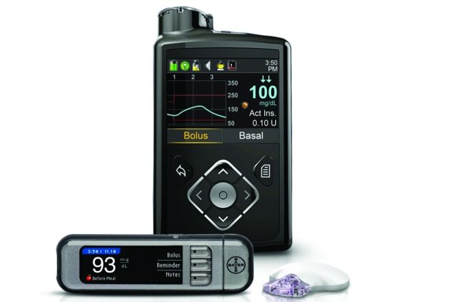 Review: Medtronic’s Minimed 630G Insulin Pump